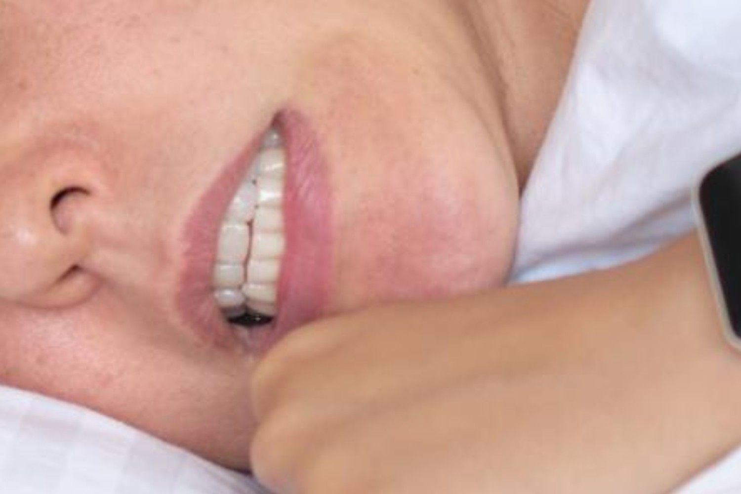 Sleep Dentistry Melbourne